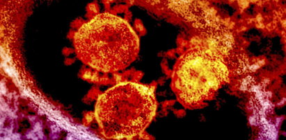 Polska kupiła testy na koronawirusa. "Wirus na pewno u nas będzie"