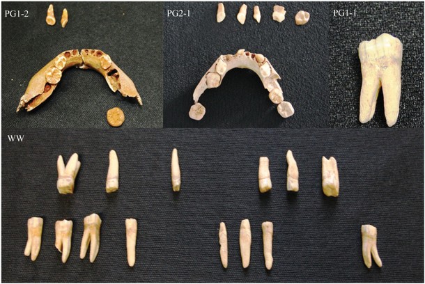 Zęby z mezolitycznych stanowisk archeologicznych: PG1-2: zęby trzyletniego dziecka; PG2-1: szczęka półtorarocznego dziecka; PG1-1: ząb osoby dorosłej z Pierkunowa-Giżycka; WW: znaleziska z Woźnej Wsi.