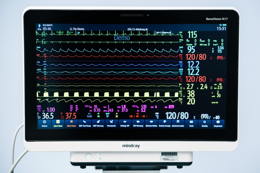 Stanje pacijenata prati se na monitoru povezanom sa respiratorom