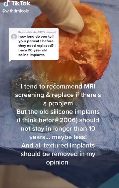 Pacientke vyoperovali 35 rokov staré silikóny. 