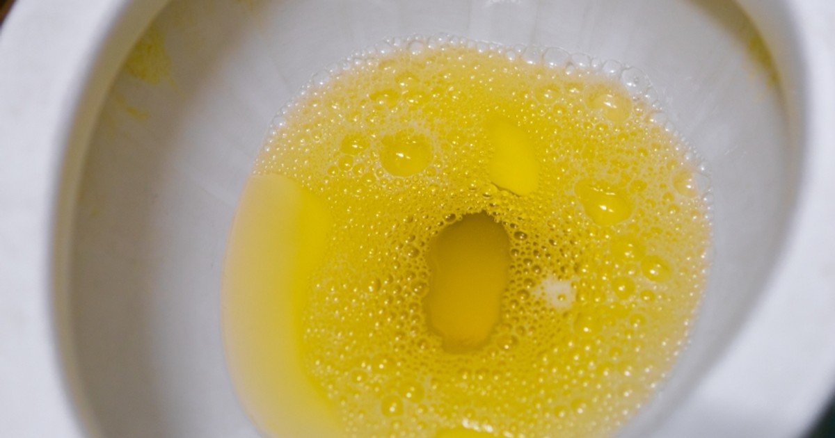 Why your urine is yellow Pulse Ghana