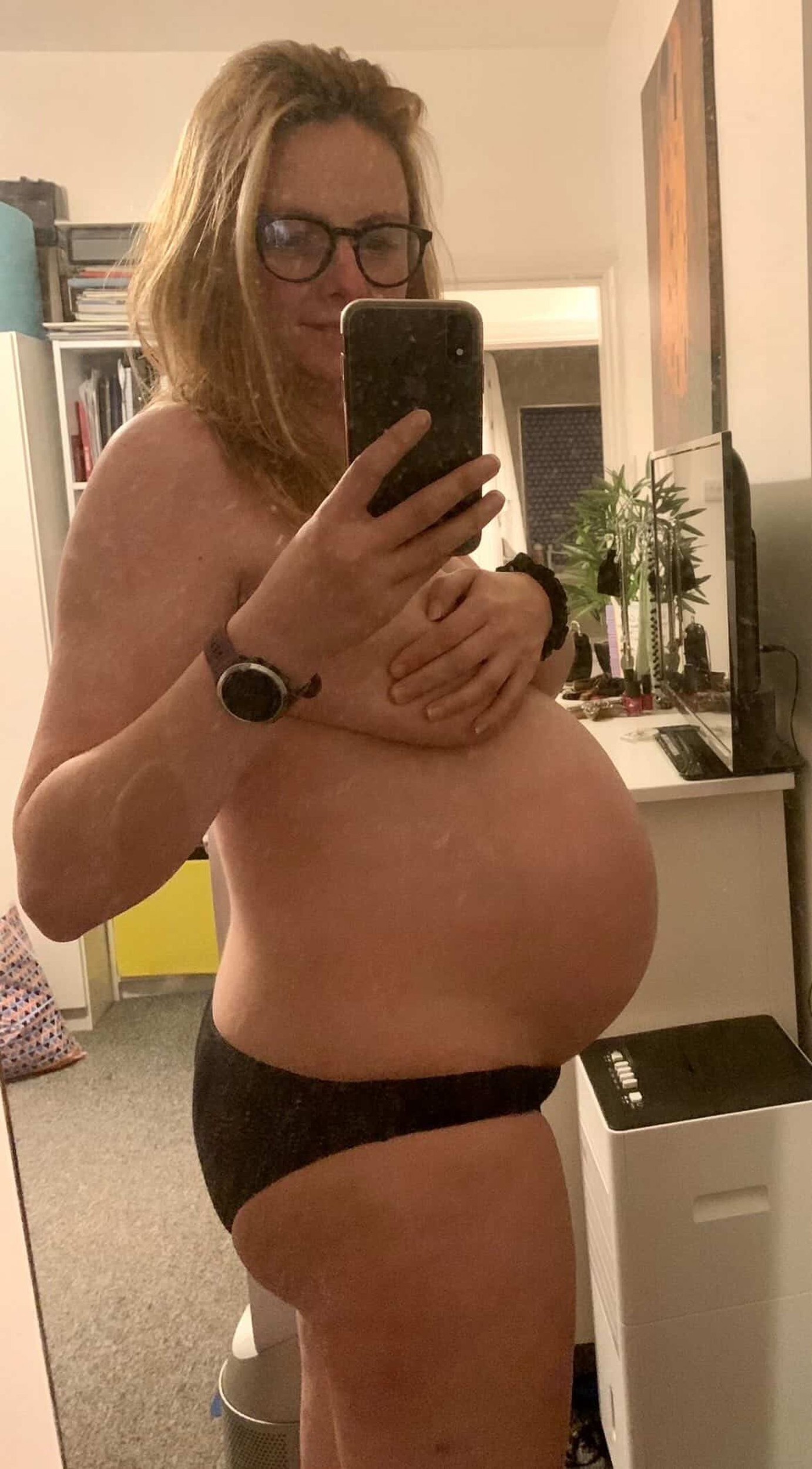 Gemma si prvé príznaky všimla už počas tehotenstva.