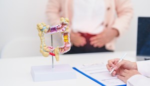 Bol kod raka debelog creva često ne počinje naglo niti dramatično