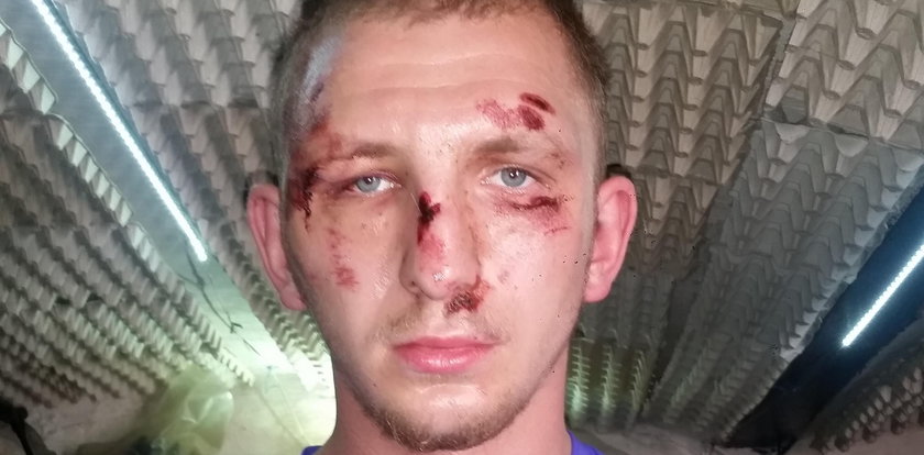 Policjanci mieli brutalnie pobić 24-latka. Komendant podjął decyzję