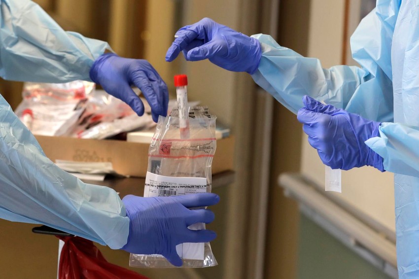 Serološki testovi pokazuju prisustvo antitela u organizmu