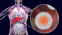 Kontakt z wirusem HCV mogło mieć 90 proc. Polaków. Pierwsze objawy nawet po 30 latach