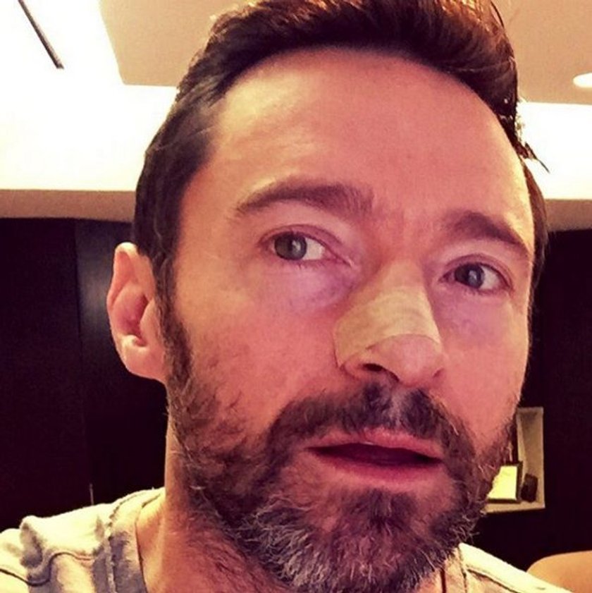 Hugh Jackman