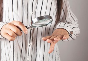 Žuti nokti su najčešće posledica svakodnevnih navika ili gljivičnih infekcija