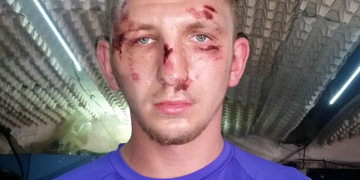 24-letni Kamil oskarża słupskich policjantów o brutalne pobicie