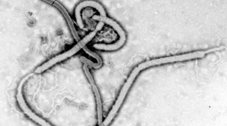 Meggyógyult két Ebola-vírussal fertőzött beteg