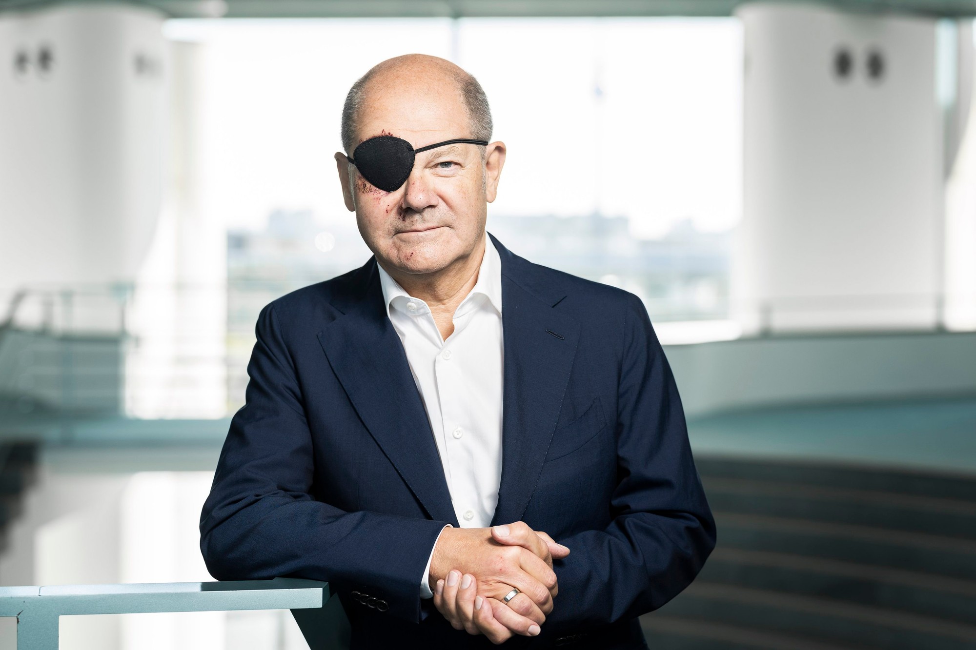 Nemecký kancelár Olaf Scholz sa zranil pri behu.