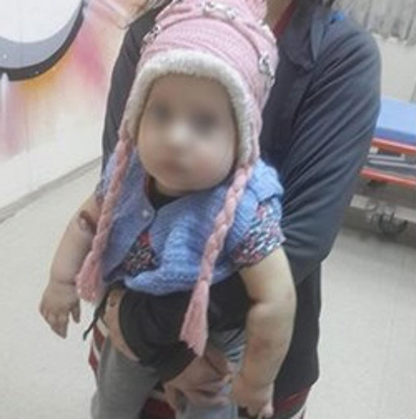 Turcja: Matka miesiącami torturowała córkę. Bo jej nie kochała