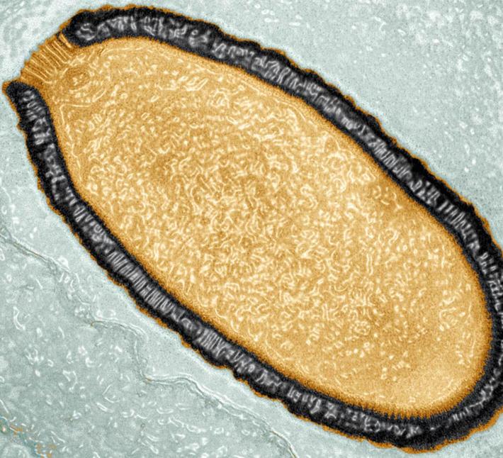Pithovirus sibericum wirusy klonowanie medycyna nauka