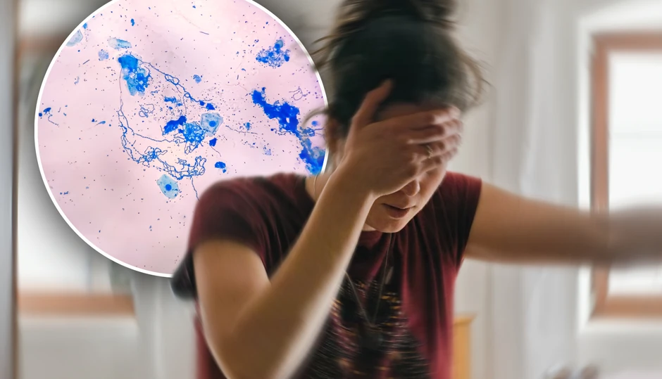 Moždani udar smanjuje svoju učestalost kod starijih ljudi, ali postoji jasan porast pojave moždanih udara kod mlađih ljudi.