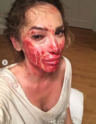 Ewelina Ślotała pokazała drastyczne zdjęcie po pobiciu