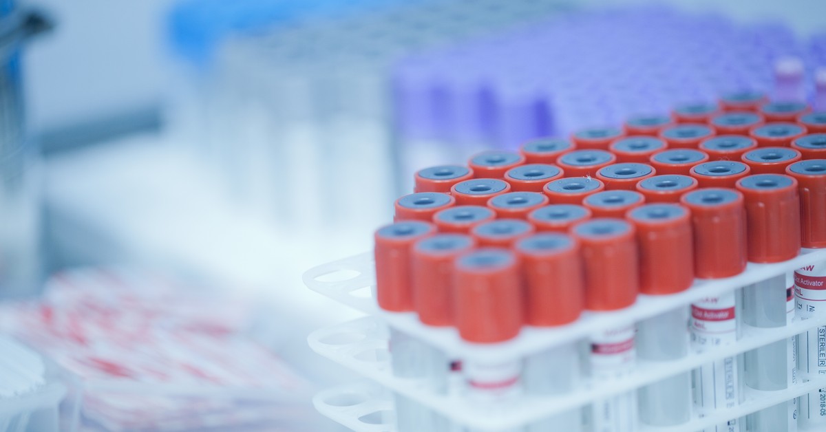 Badania krwi pracownika – kiedy są obowiązkowe i od czego zależy ich zakres