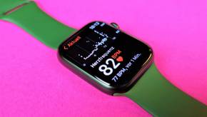 Apple Watch SE (2023) GPS 40 mm Aluminium mit Sport Band (MR9X3QF/A)  Preisvergleich