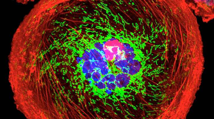 Fluoreszkáló festékkel színesítik a rákos sejteket, hogy lássák, miként reagálnak/Fotó:Northfoto