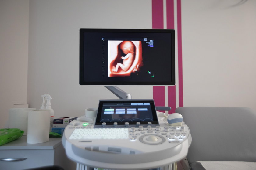 Otwarto Centrum Diagnostyki Prenatalnej