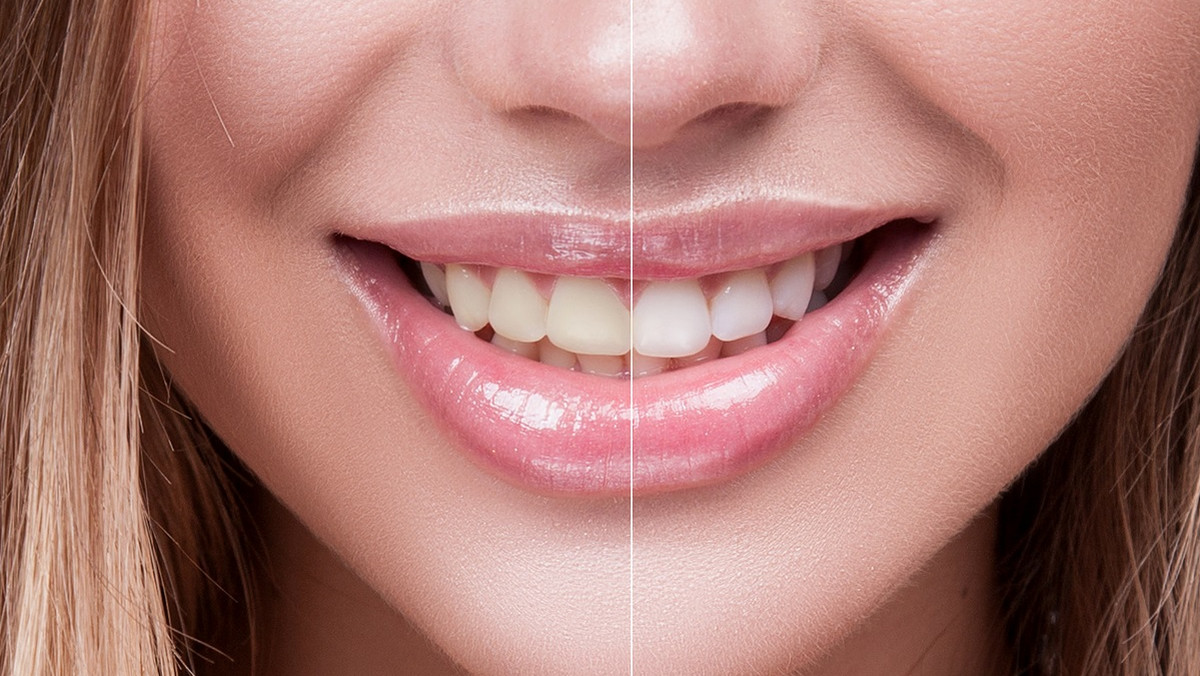 Pasty wybielające do zębów — różnicę zauważysz już po kilku dniach
