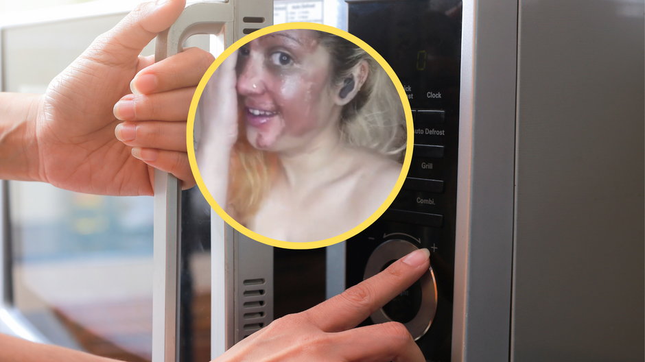 Testowała trik z TikToka. Poparzyła sobie twarz (fot. screen: tiktok.com/@shaf_backupaccount321)