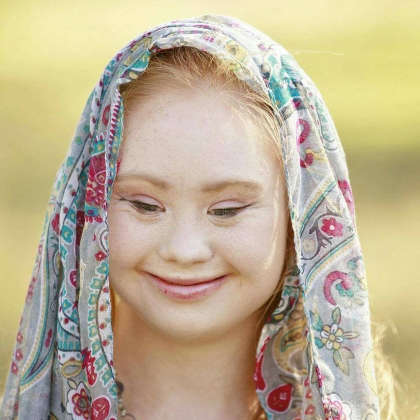 Madeline Stuart - modelka z zespołem Downa