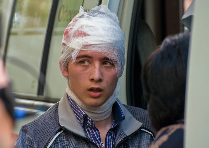 Ranny w starciach w Odessie