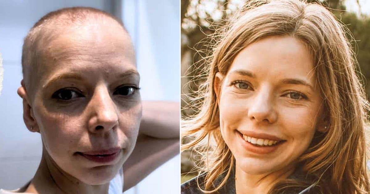 Kornelia walczy o życie: Jak system opieki zdrowotnej zawodzi przy rzadkich wznowach chłoniaka