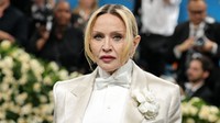 Mi történt Madonna mosolyával? A rajongók szerint az egyik legjellegzetesebb vonását változtatta meg