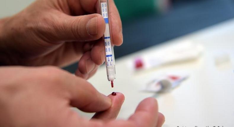 FG approves new test kit for HIV. [dw]