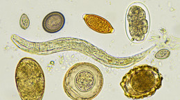 Pasożyty ludzkie: przyczyny, objawy, leczenie