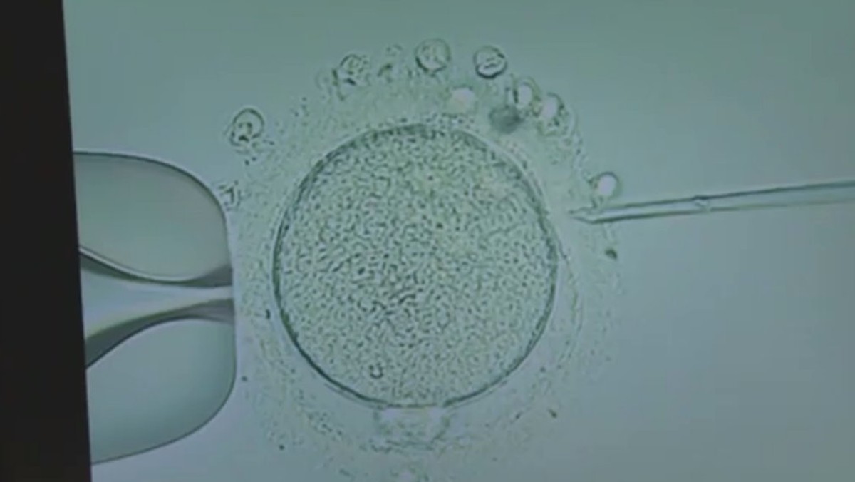 Samotne kobiety nie mogą korzystać z in vitro, nawet jeśli chcą użyć zarodków już utworzonych z ich komórek jajowych - wynika z ustawy, która wchodzi w życie z początkiem listopada. Zdaniem Rzecznika Praw Obywatelskich przepisy te mogą być niekonstytucyjne.