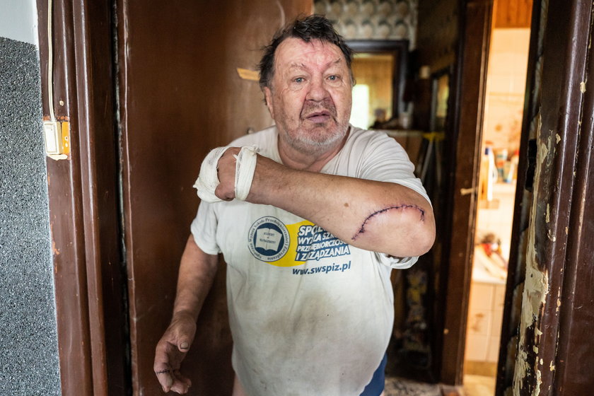 76-letni pan Zenon został napadnięty we własnym domu. Sąsiad zaatakował go maczetą