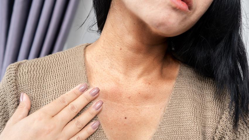 sötét szürke folt elszíneződés bőr acanthosis nigricans