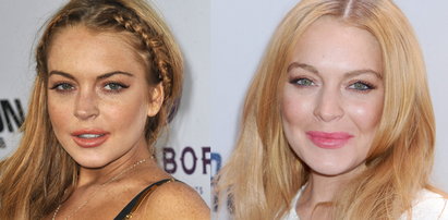 Lindsay Lohan usuwa piegi!