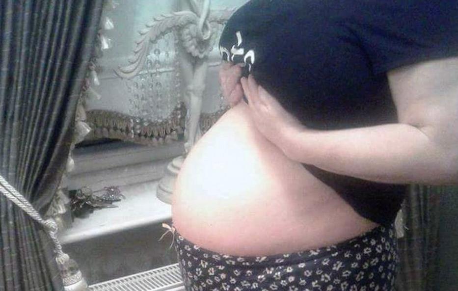 Ez a nő 3 éven keresztül volt terhes. Ez volt az oka!