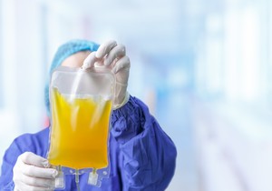 Krvna plazma ima boju slame i blago je zamućena