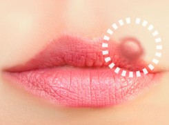 Co robić, gdy opryszczka nie odpuszcza. Przepisy na lecznicze mazidła