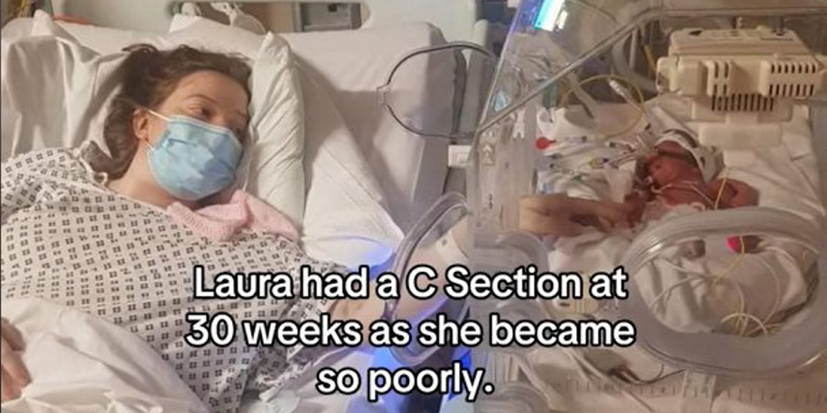 U Laury 20. tygodniu ciąży zdiagnozowano raka mózgu. Tydzień po cesarskim cięciu kobieta znalazła się na bloku operacyjnym.