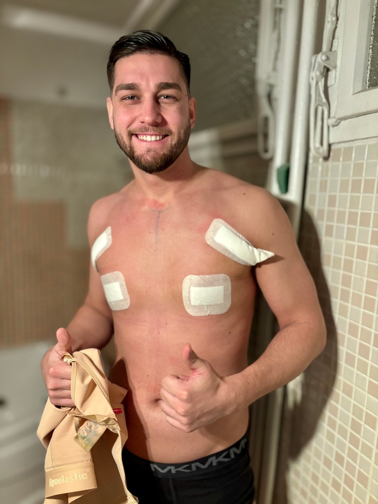 VV Barna could first bathe after breast surgery