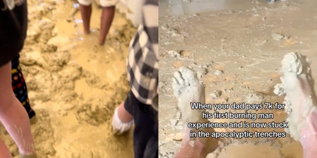 Trench Foot 2023 TikTok videos show Burning Man attendees walking  barefoot in the mud Heres how to avoid contracting the condition in damp  environments  Business Insider Africa