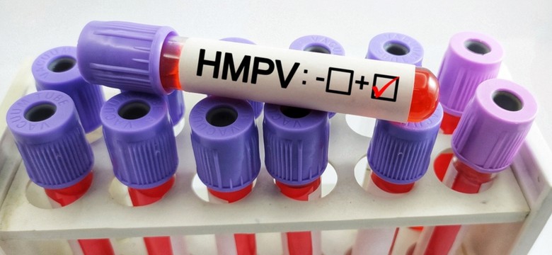 Wirus HMPV będzie się rozprzestrzeniał jak SARS-CoV-2? Ekspertka mówi o ryzyku