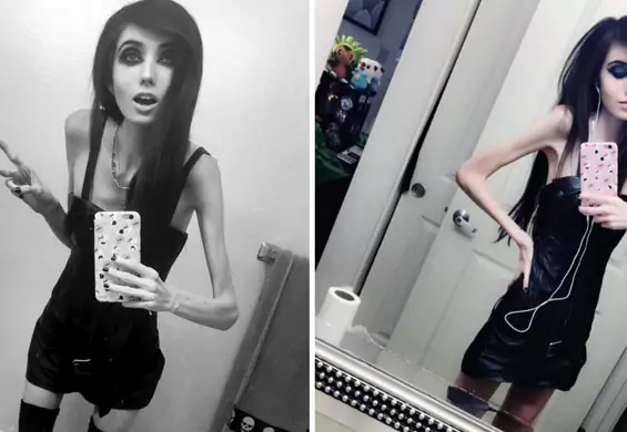 Blogerka urodowa z anoreksją? Fani napisali petycję o usunięcie jej konta