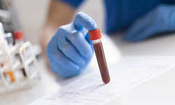 Testy genetyczne – jakie nowotwory można przewidzieć?