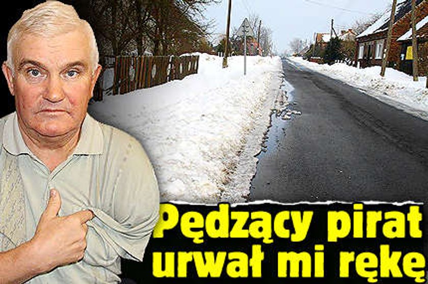 Pędzące auto urwało mi rękę