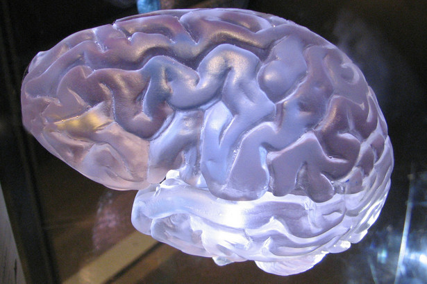 Od lat 30. XX wieku rozmiar mózgów ludzi cały czas się zwiększał – wskazuje obejmujące kilka dekad badanie.