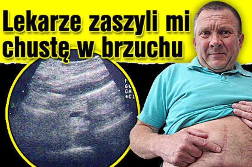 Zaszyli mi chustę w brzuchu!