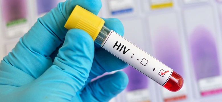 W Polsce wciąż umierają pacjenci na AIDS, a liczba nosicieli HIV stale rośnie