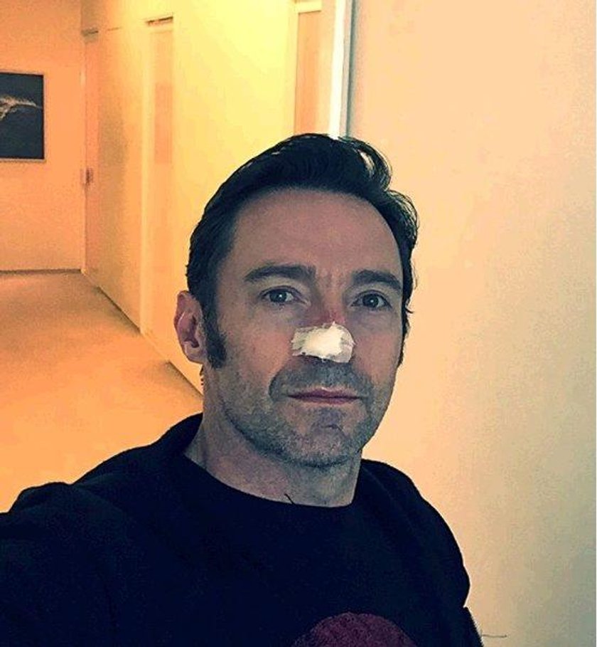 Hugh Jackman 