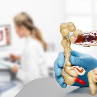 Őssejtekkel segítik a Crohn-betegek gyógyulását a Semmelweis Egyetemen